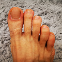 Pope's Toes