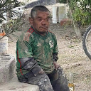 Ptoe Flácido