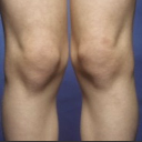 KnobblyKnees